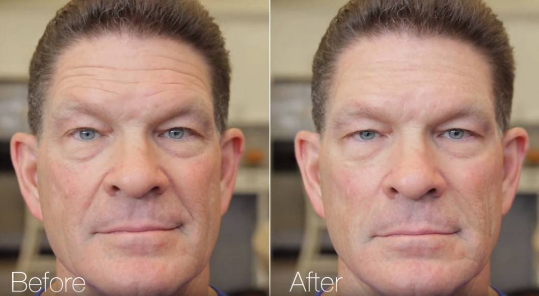 Terry-Silkman-Before-After